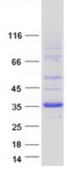 SDS-PAGE (DHRS9-1997H).jpg